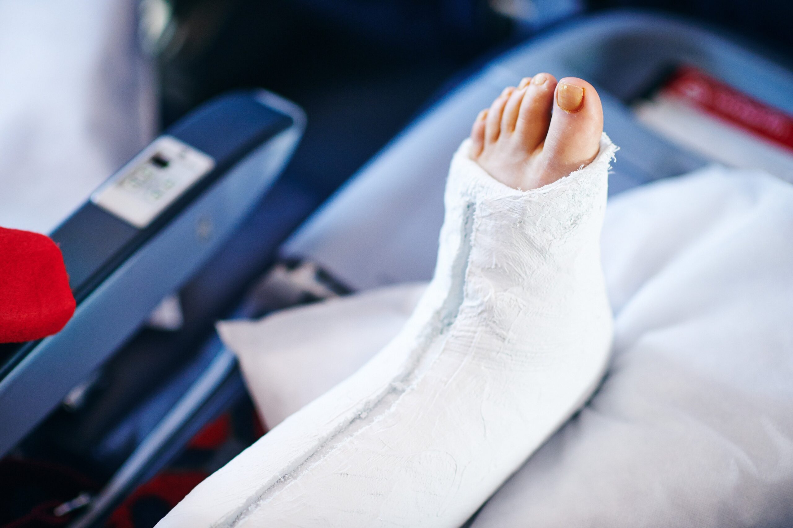 Leg in a cast belonging to a patient on a medical evacuation flight
